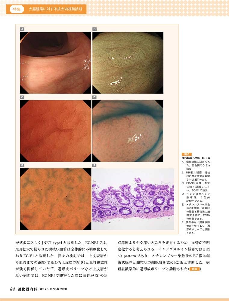 消化器内科 ♯８（Ｖｏｌ．２　Ｎｏ．７　２/医学出版（単行本） 消化器内科 第9号（Vol.2 No.8，2020）特集：大腸腫瘍に対する